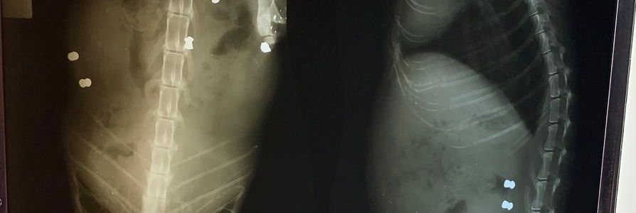 radiografie