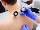 Melanoma day: Piemonte in prima linea per la prevenzione e cura dei tumori della pelle Melanoma day: Piemonte in prima linea per la prevenzione e cura dei tumori della pelle