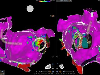 Il dottor Scaglione alla console della sala di Elettrofisiologia del Cardinal Massaia