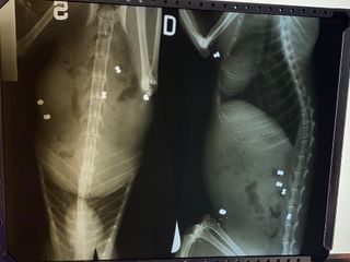 radiografie