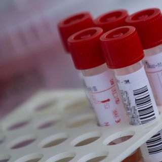 Aggiornamento Covid in Piemonte: in calo i nuovi positivi, ma aumentano i ricoveri