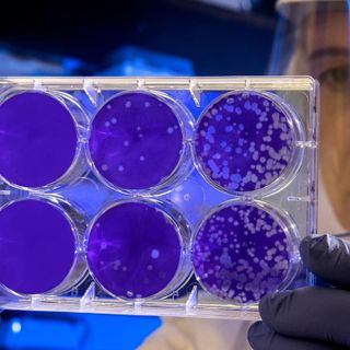 Coronavirus, in Piemonte salgono a 5 i decessi. 166 i casi positivi, alle Molinette riapre Medicina [VIDEO]