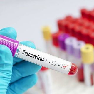 Coronavirus, oggi si registrano 19 nuovi positivi nell'Astigiano, in Piemonte  401