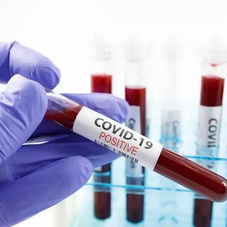 Covid: accertati in Piemonte altre 15.733 positivi, 36 i nuovi decessi