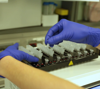 Coronavirus, ad Asti sono 95 i decessi in totale. 806 le persone positive