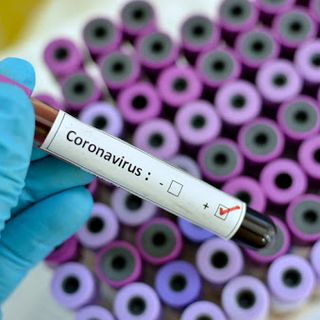 Coronavirus: per il Presidente della Regione ci sarebbero le condizioni per chiedere al Governo un graduale ritorno alla normalità
