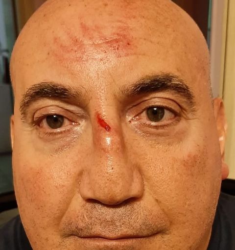 Troppe buche sulle strade astigiane costano la caduta dalla carrozzina ad un disabile. &quot;Grazie alla disponibilità dei passanti sono riuscito a tornare a casa&quot;