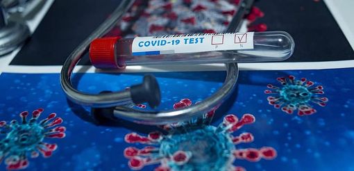 Covid-19, nell'Astigiano un nuovo decesso e 133 nuovi positivi. Cresce ancora la curva in Piemonte Covid-19, nell'Astigiano un nuovo decesso e 133 nuovi positivi. Cresce ancora la curva in Piemonte
