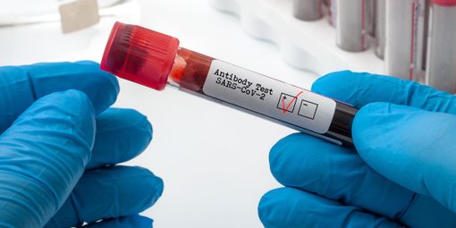 Aggiornamento Covid in Piemonte: boom di nuove guarigioni (+ 2.129) e contagi in netto calo (+ 952, con 43% di asintomatici) Aggiornamento Covid in Piemonte: boom di nuove guarigioni (+ 2.129) e contagi in netto calo (+ 952, con 43% di asintomatici)