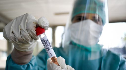 4 nuovi decessi nell'astigiano a causa del coronavirus. I guariti (96) sono più dei nuovi positivi (81)