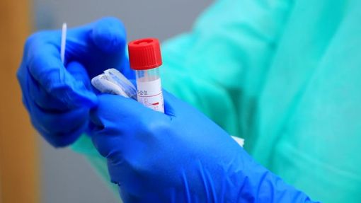 Focus covid in Piemonte: contagi in aumento ma la situazione resta sotto controllo Focus covid in Piemonte: contagi in aumento ma la situazione resta sotto controllo