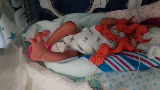 Il neonato pretermine, un universo da conoscere ed esplorare. La testimonianza di una pediatra astigiana