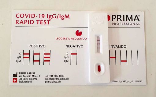 Dal 15 gennaio i test rapidi anti Covid saranno conteggiati nel bollettino nazionale