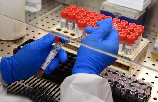 Bollettino Covid in Piemonte: un nuovo decesso, 74 positivi e 50 pazienti guariti