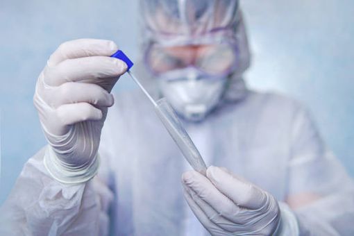 Covid-19, nell'Astigiano 106 nuovi positivi e 4 nuovi decessi. Nuovo aumento di guariti + 172