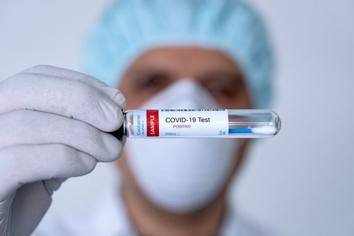 Covid: in Piemonte la curva dei contagi è decrescente