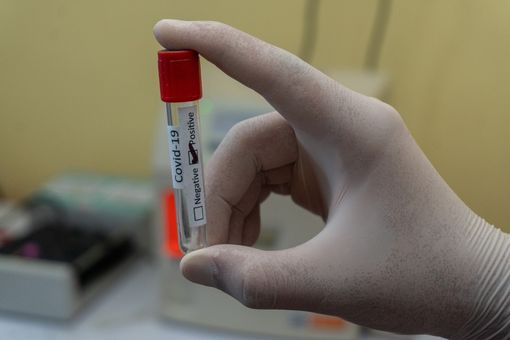 Aggiornamento Covid-19 in Piemonte: nessun decesso, 39 positivi al tampone e 14 nuovi guariti