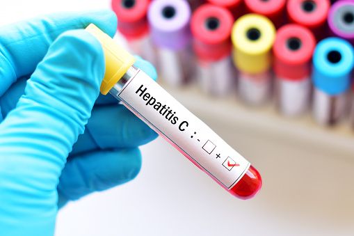 Obiettivo 2030, il Piemonte accelera sulla caccia al virus dell’epatite Obiettivo 2030, il Piemonte accelera sulla caccia al virus dell’epatite