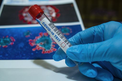 Coronavirus, il bollettino di oggi, sabato 18 luglio. Situazione stabile in tutta la regione