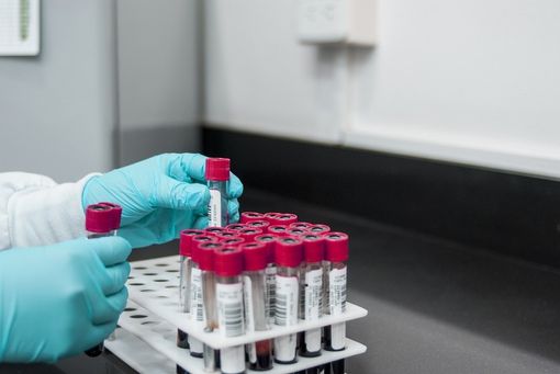 Vaiolo delle scimmie. Individuato un caso in Piemonte, in un cittadino tornato dall'estero Vaiolo delle scimmie. Individuato un caso in Piemonte, in un cittadino tornato dall'estero