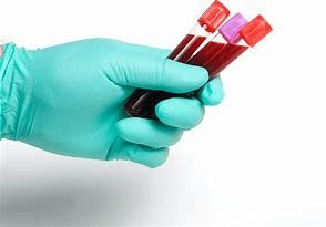 Laboratori analisi privati, il Piemonte liberalizza i punti prelievo