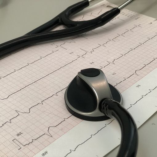 In Piemonte dal 1 maggio gli aventi diritto, potranno eseguire gratuitamente in farmacia holter cardiaco ed elettrocardiogramma