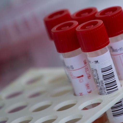 Andamento Covid: ad Asti nell'ultima settimana 205 casi. In Piemonte 7149