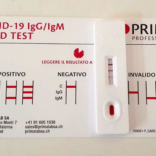 Dal 15 gennaio i test rapidi anti Covid saranno conteggiati nel bollettino nazionale