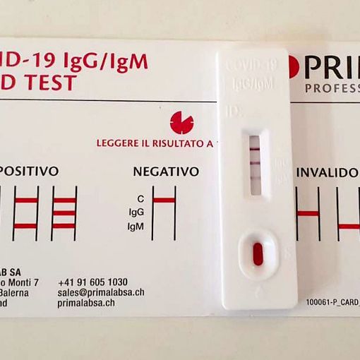 Allarme variante Covid, i test diagnostici utilizzati in Piemonte sono in grado di identificare le varianti del virus
