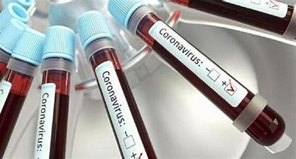 Covid: in Piemonte aumenta ancora il numero di nuovi positivi
