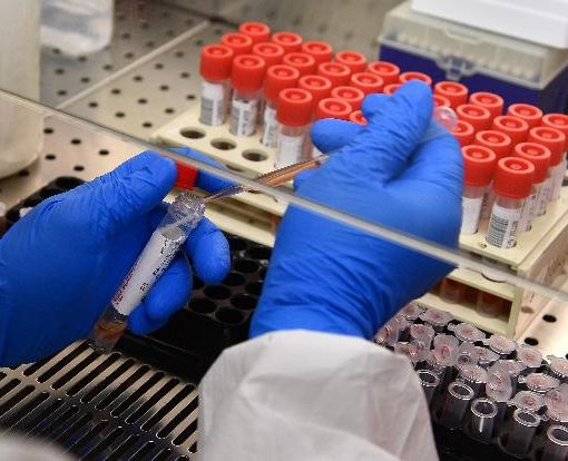 Bollettino Covid: oggi per l'Astigiano 102 nuovi positivi e 184 guariti. Non si registrano nuovi decessi