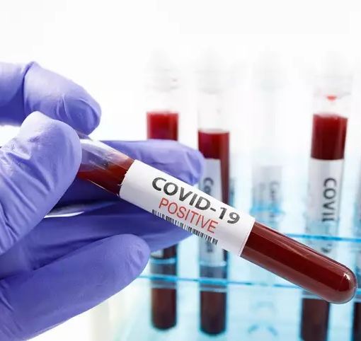 La Federazione dei Medici Sportivi vara il nuovo protocollo. Proposta la riduzione dei tempi della visita post Covid a 7 e zero giorni