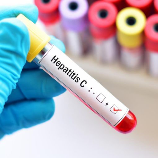 Epatite C: attivo in Piemonte lo screening per la ricerca del virus per la diagnosi precoce