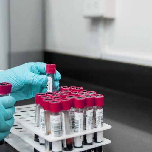 Coronavirus Piemonte, al via il 4 maggio i test sierologici sul personale sanitario