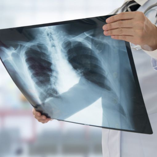 Radiologia domiciliare R@dhome: entro la fine dell'anno sarà estesa a tutto il Piemonte