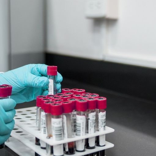 Vaiolo delle scimmie. Individuato un caso in Piemonte, in un cittadino tornato dall'estero