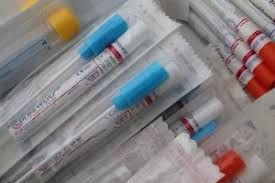 Da oggi tamponi gratuiti per gli studenti tra i 12 ed i 18 anni, dopo la prima dose, in attesa del Green pass