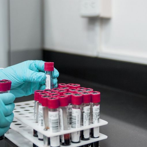 Coronavirus, il Piemonte ha la più alta percentuale di persone tracciate con il test virologico
