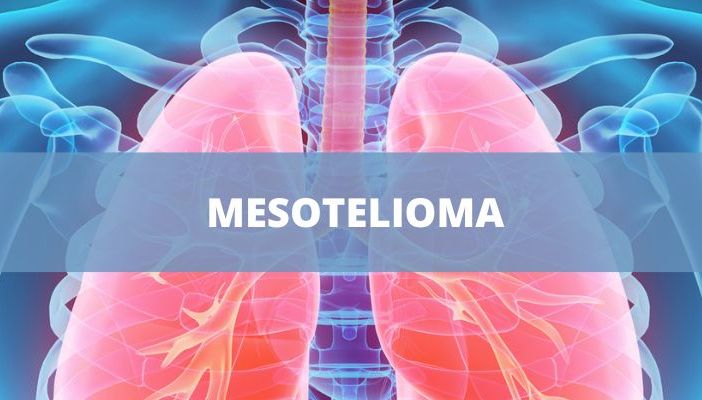 Aumento dei casi di mesotelioma in Liguria, Piemonte, Lombardia e Abruzzo