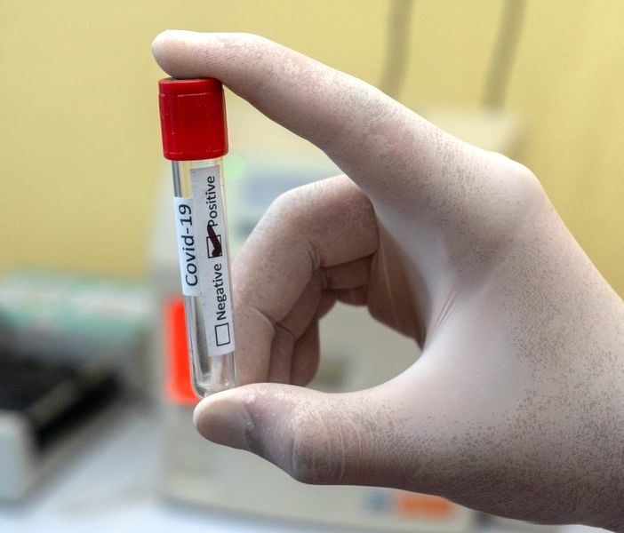 Medico di base positivo al Covid-19: scattano i controlli a Cortazzone, Cortanze, Piea e Soglio