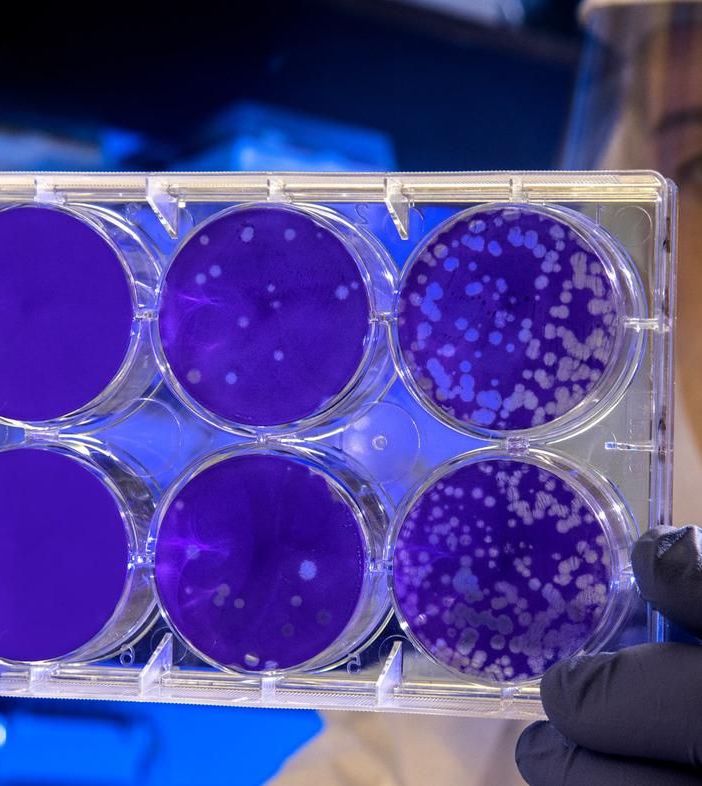 Coronavirus, da oggi disponibile in Piemonte il test molecolare specifico