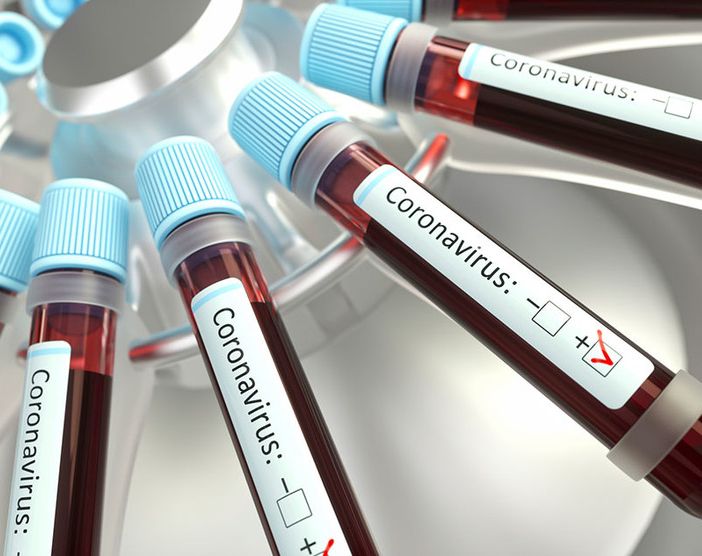 Emergenza Coronavirus: breve guida per aziende e lavoratori