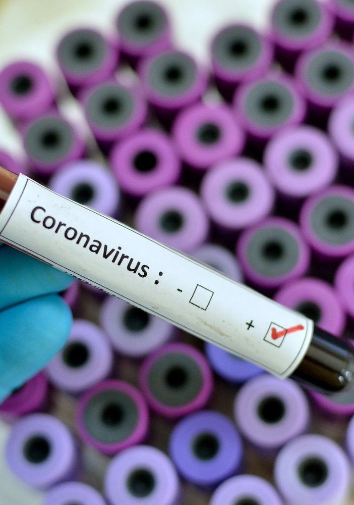 Coronavirus, oggi ad Asti 5 decessi, ma salgono a 212 i guariti da inizio emergenza