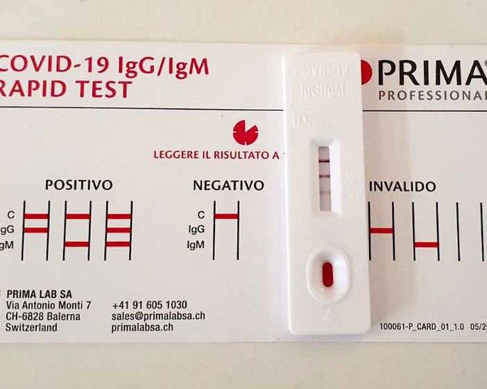Dal 15 gennaio i test rapidi anti Covid saranno conteggiati nel bollettino nazionale