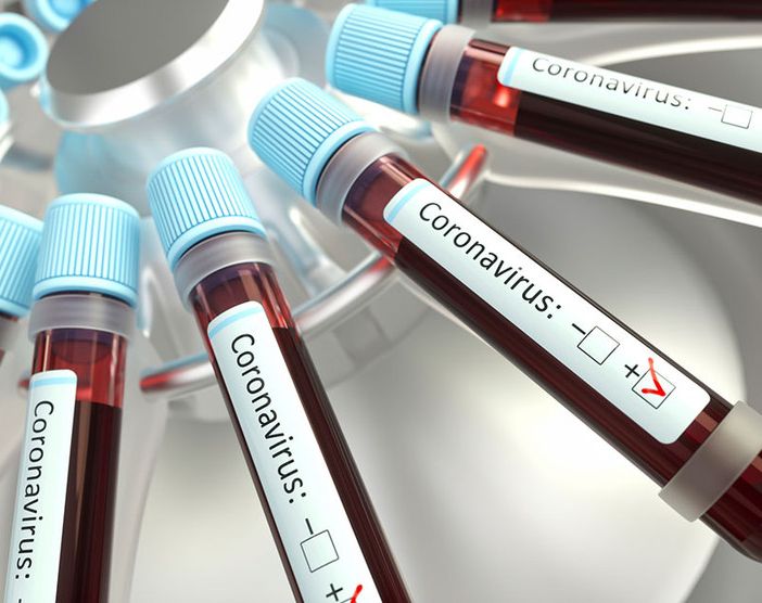 Coronavirus, in Piemonte 16 nuovi positivi. Asti ferma a quota 1900