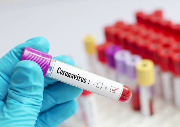 La Regione Piemonte lancia un bando per incrementare il numero di laboratori che processano tamponi Covid