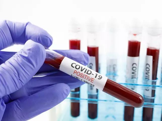 Covid: accertati in Piemonte altre 15.733 positivi, 36 i nuovi decessi