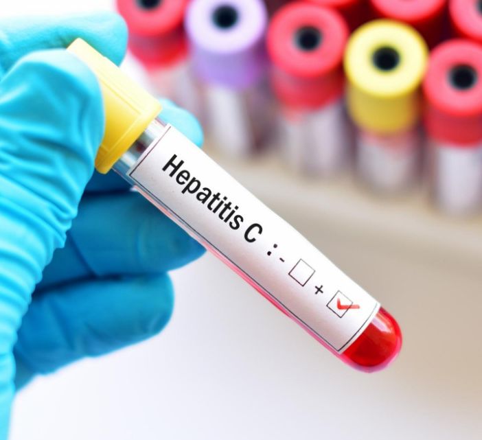 Epatite C: attivo in Piemonte lo screening per la ricerca del virus per la diagnosi precoce