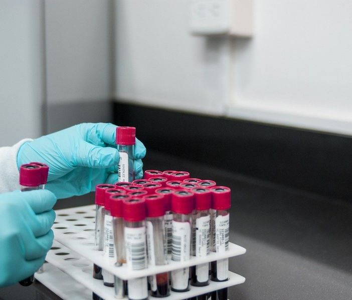 Coronavirus Piemonte, al via il 4 maggio i test sierologici sul personale sanitario