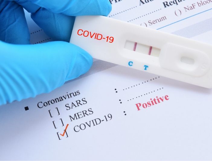 Un test rapido Covid 19 positive